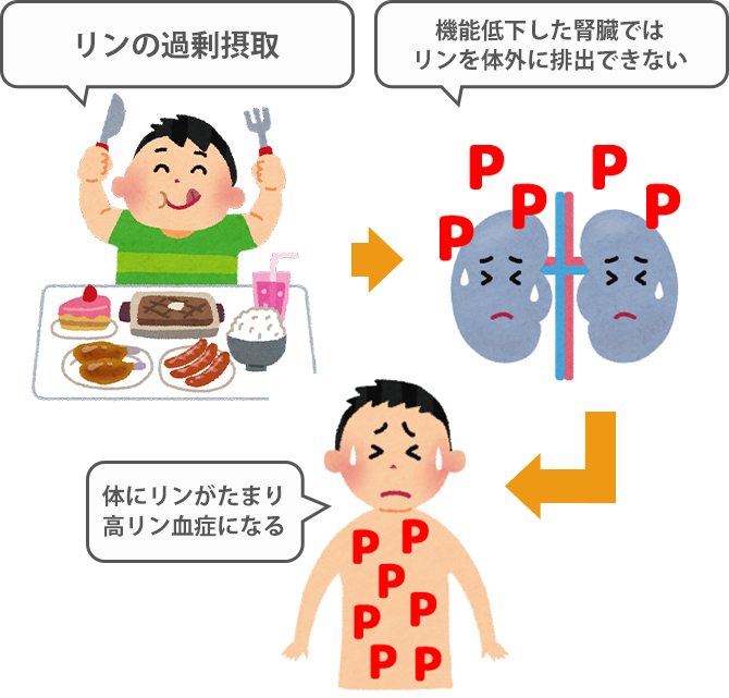 透析患者の食事リンガイドライン | 透析 食事制限 ガイドライン – PFRKR